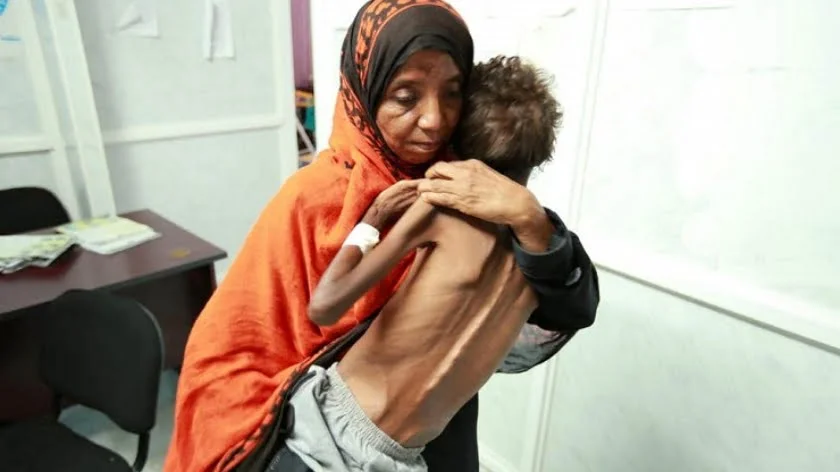 Ongoing Armed Conflict in Yemen is Humanity’s Shame